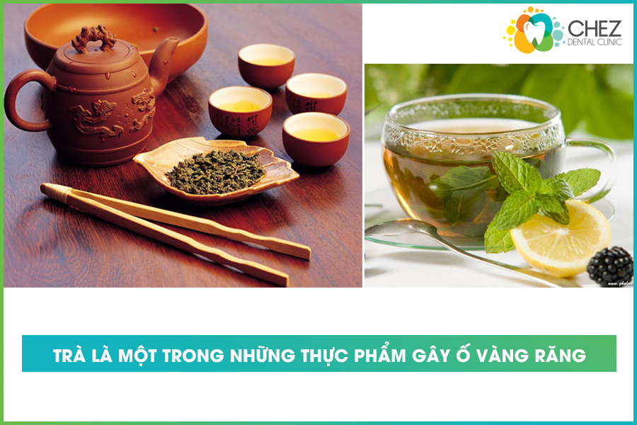 Trà là một trong những thực phẩm gây ố vàng răng