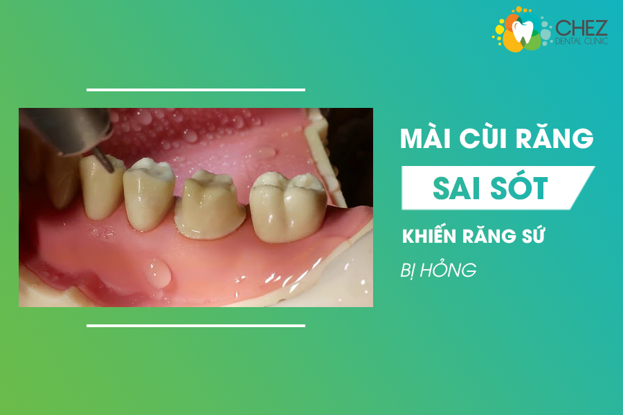 Mài cùi răng sai sót khiến răng sứ bị hỏng