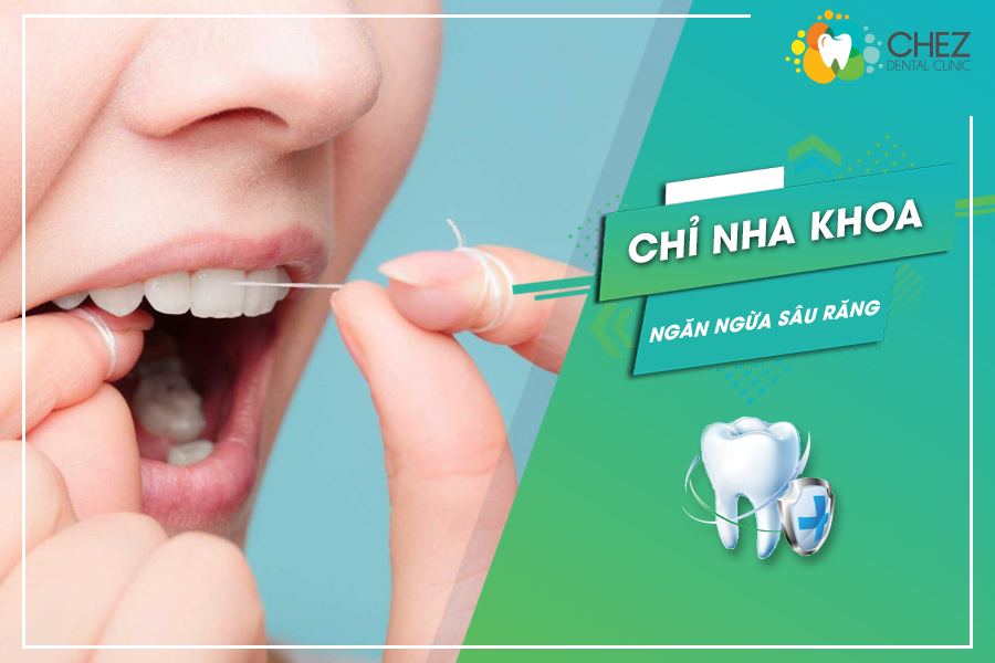 Chỉ nha khoa - Ngăn ngừa sâu răng