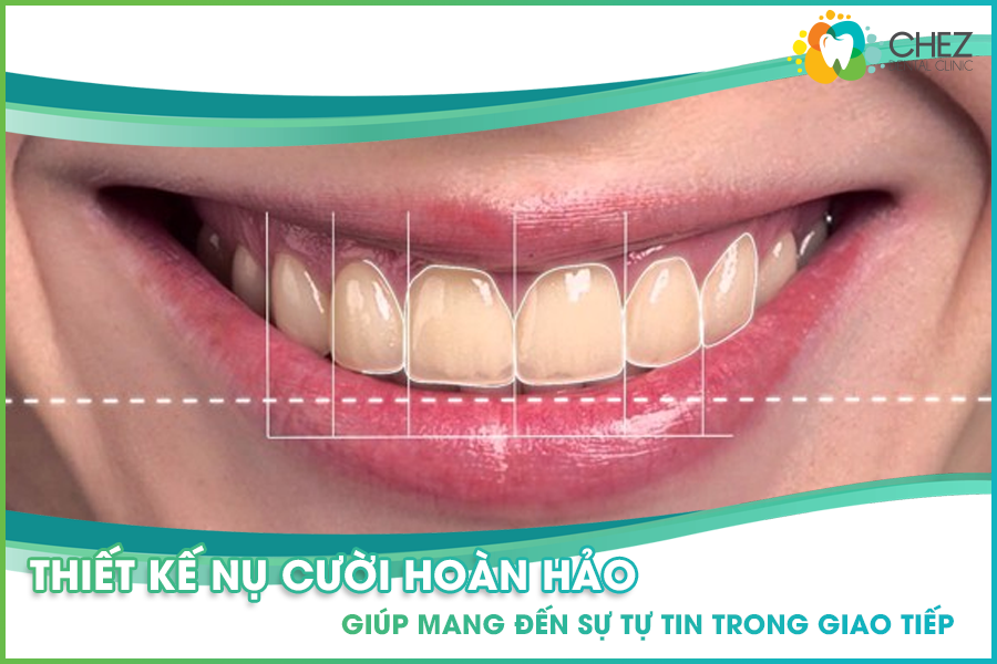 Thiết kế nụ cười hoàn hảo