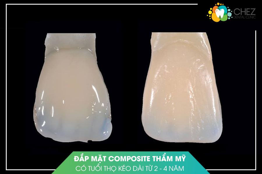 Tuổi thọ kéo dài từ 2 đến 4 năm