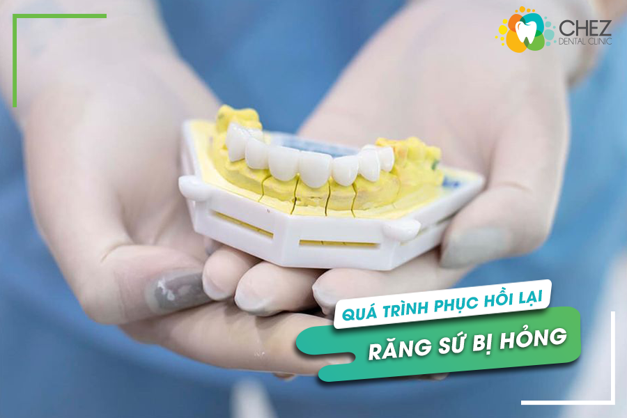 Phục hồi lại răng sứ bị hỏng