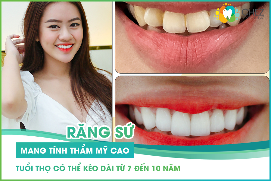 Răng sứ mang tính thẩm mỹ cao
