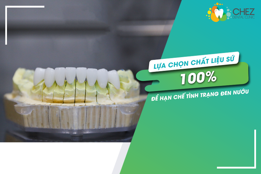 Lựa chọn chất liệu sứ 100%