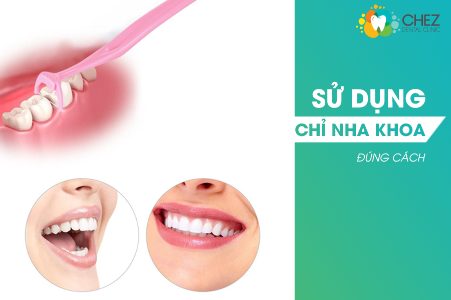 Sử dụng chỉ nha khoa đúng cách