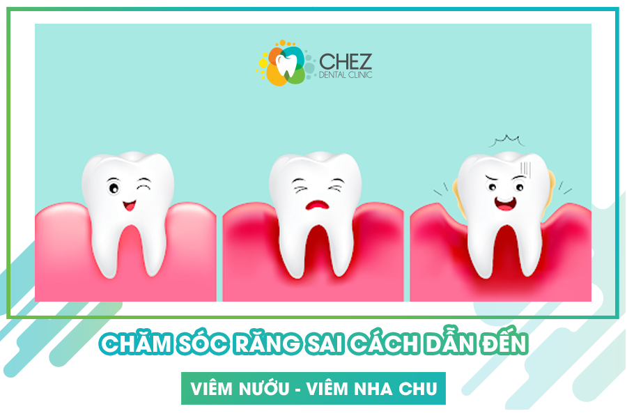 Chăm sóc răng sai cách dẫn đến viêm nướu, viêm nha chu