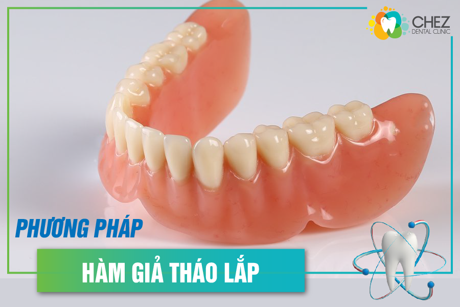 Phương pháp “hàm giả tháo lắp”