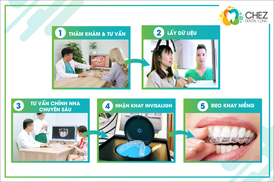 Quy trình niềng răng không mắc cài tại Chez Dental Clinic