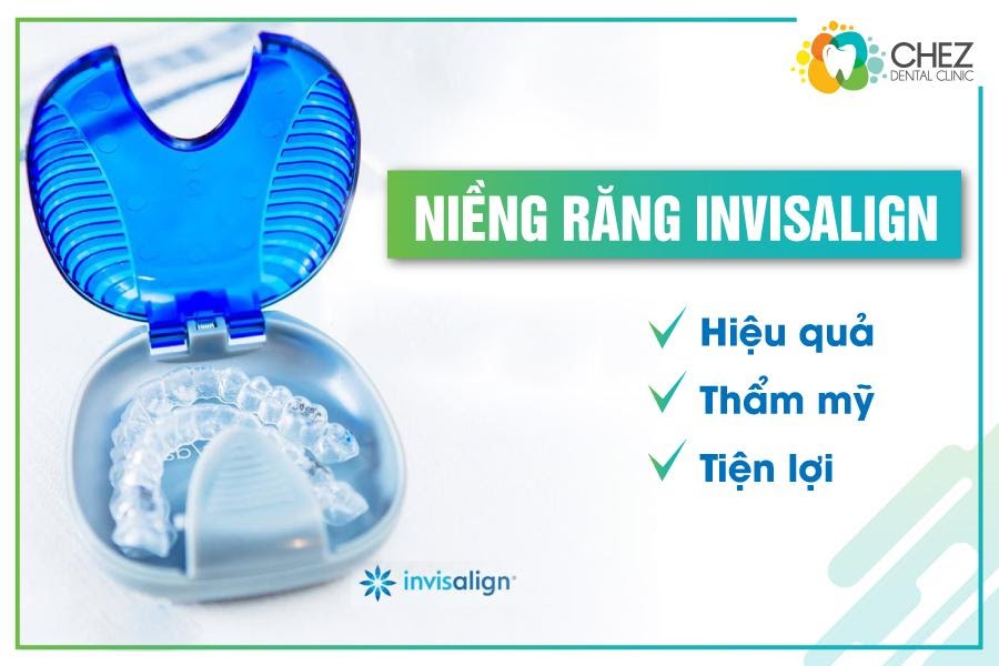 Ưu điểm của niềng răng không mắc cài