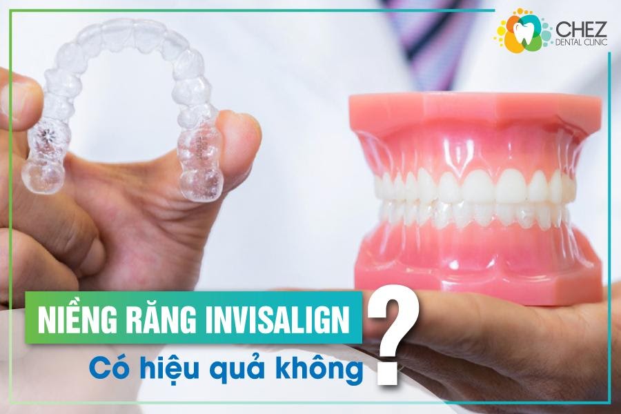 Niềng răng Invisalign có hiệu quả không?