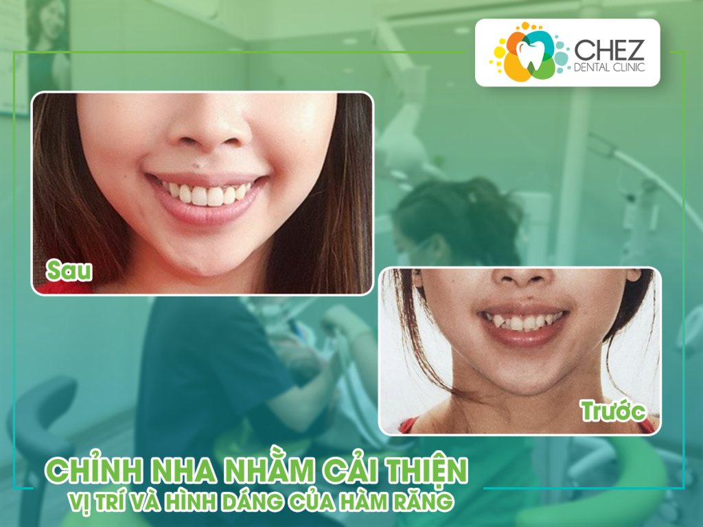 Hình 2: Mục đích của việc chỉnh nha