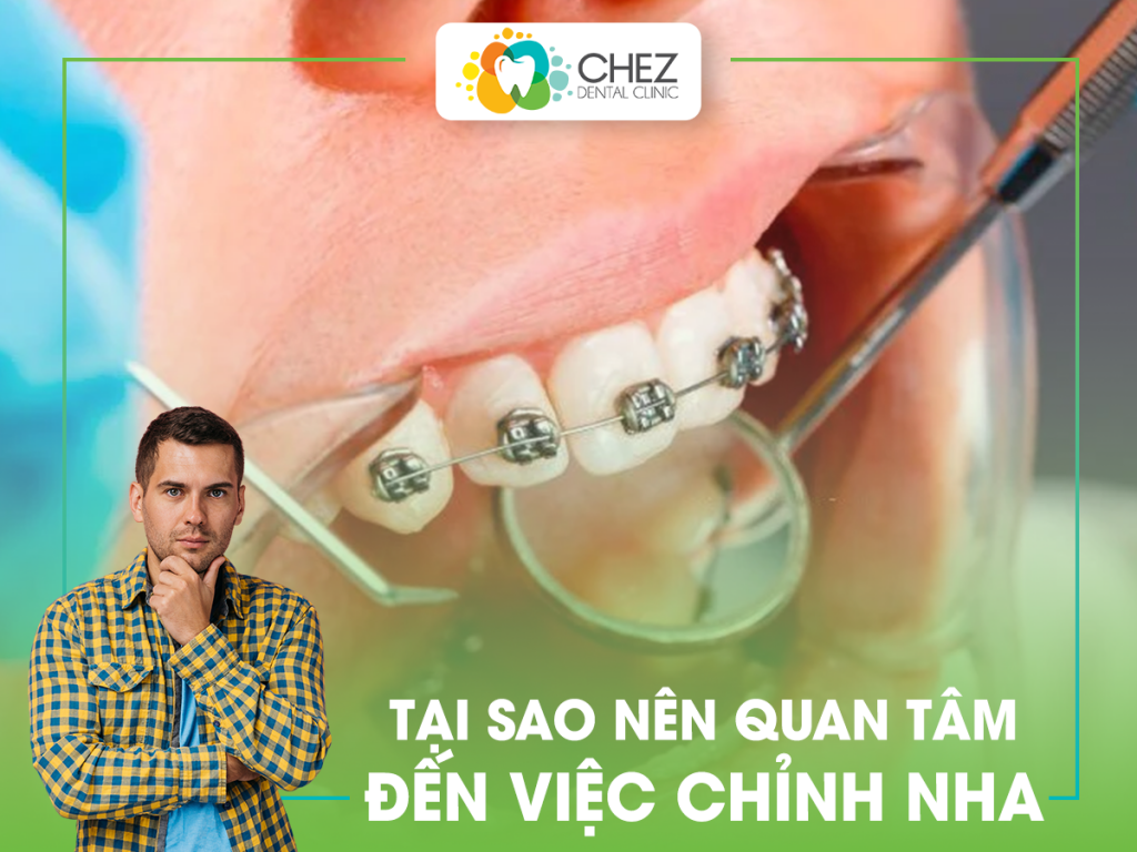 Hình 3: Tại sao nên chỉnh nha?