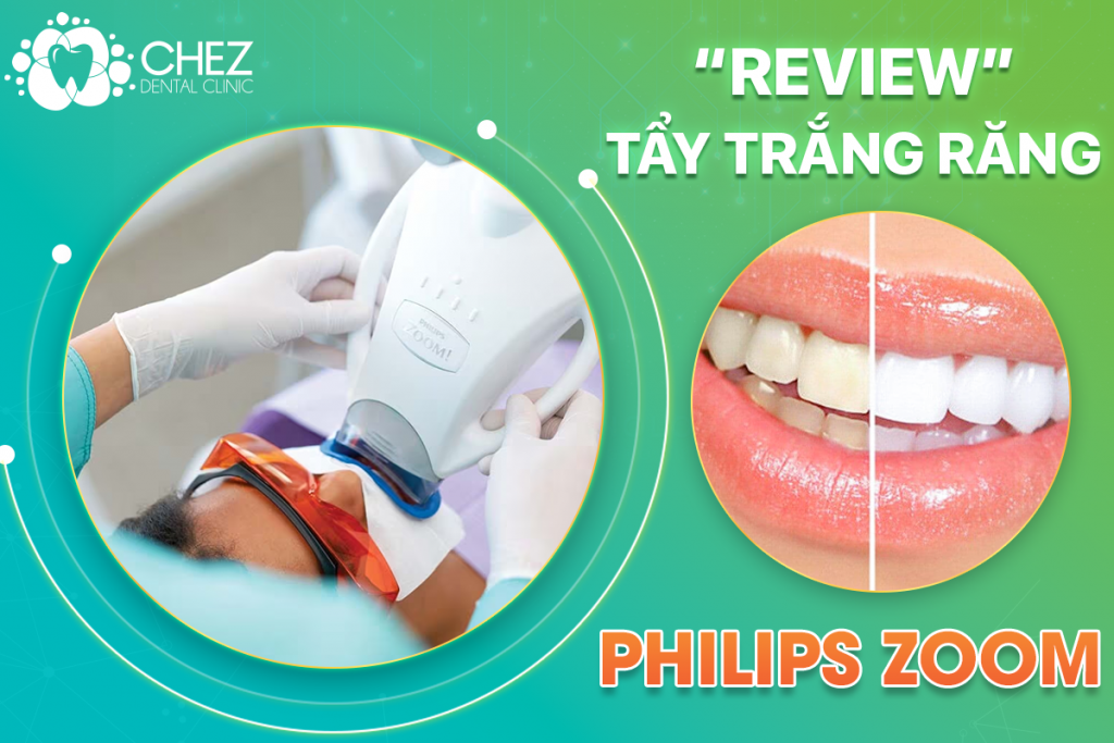 REVIEW TẨY TRẮNG RĂNG PHILIPS ZOOM 